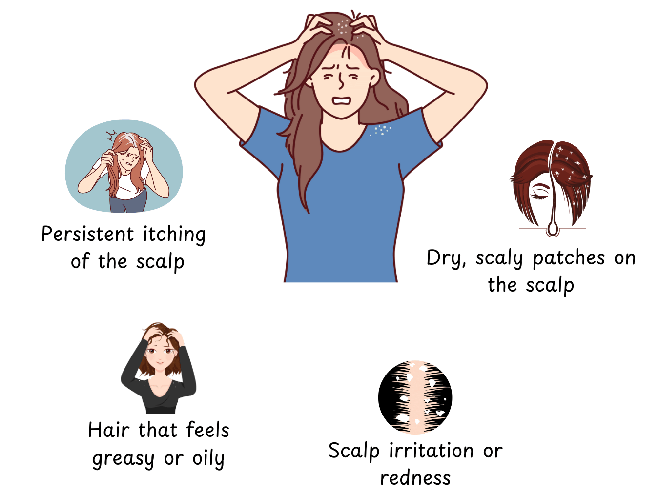 How to Remove Dandruff from Your Scalp (15 Powerful Ways to Say Goodbye for Good!) 2 1 edited