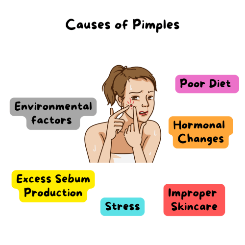 face cream for pimples