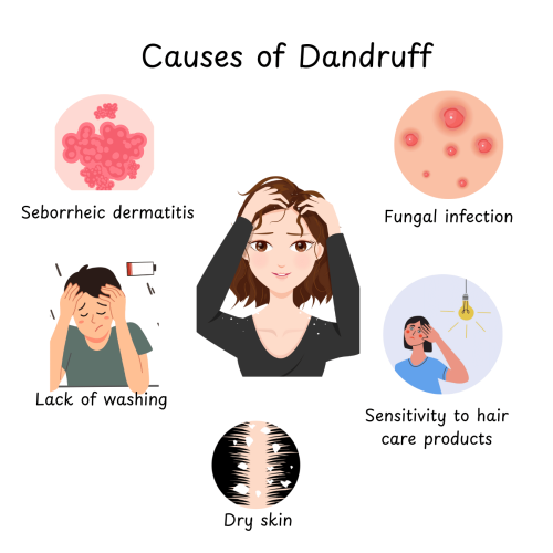 How to Remove Dandruff from Your Scalp (15 Powerful Ways to Say Goodbye for Good!) 3 2