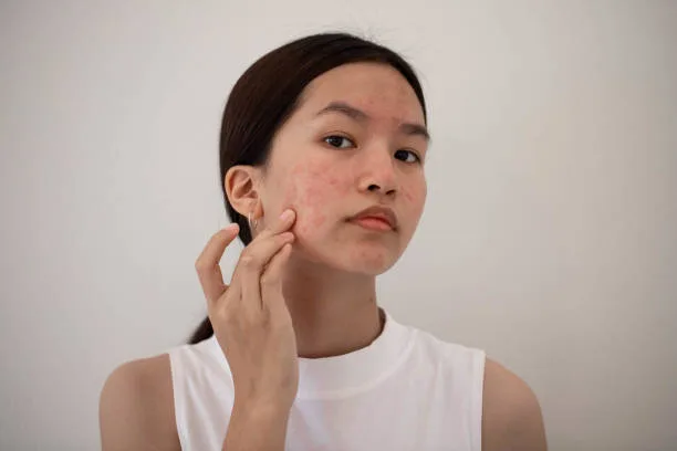 Ayurvedic Tips for Sensitive Skin: A Gentle Routine That Works 3 ayurvedic tips for sensitive skin